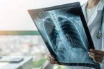 تخصص بیماری های تنفسی در هلند