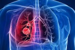 تخصص بیماری های تنفسی در آلمان